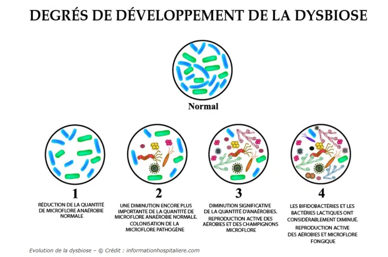 Vous avez dit dysbiose ?